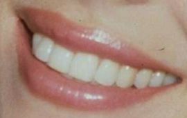 Picture of Elizabeth Hurley teeth and smile