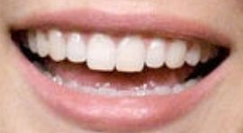 Picture of Elizabeth Olsen teeth and smile