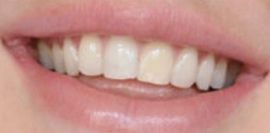 Picture of Ellie Goulding teeth and smile