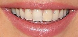 Picture of Ellie Goulding teeth and smile