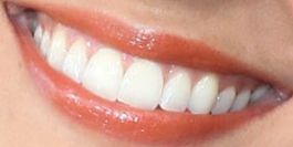 Picture of Emilie Ullerup teeth and smile