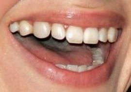 Picture of Emily Hampshire teeth and smile