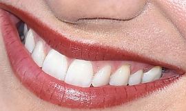 Picture of Emily Wickersham teeth and smile