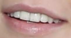 Emma Chamberlain's teeth