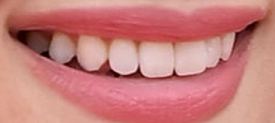 Picture of Emma Roberts teeth and smile