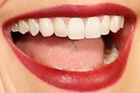 Picture of Emma Watson teeth and smile