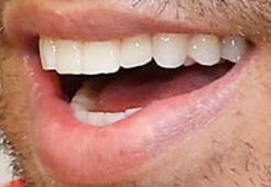 Picture of Enrique Iglesias teeth and smile