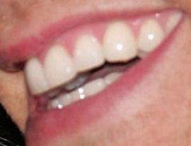 Picture of Eric Martsolf teeth and smile
