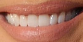 Picture of Erika Jayne teeth and smile
