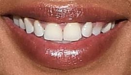 Picture of Eva Marcille Sterling teeth and smile
