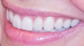 Picture of Evangeline Lilly teeth and smile