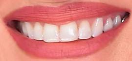 Picture of Faith Hill teeth and smile