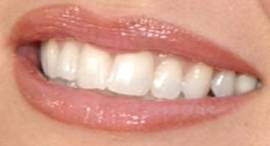 Picture of Faith Hill teeth and smile