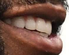 Floyd Mayweather Jr's teeth and smile
