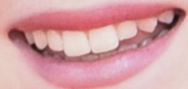Picture of Francesca Capaldi teeth and smile