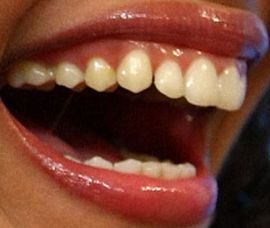 Picture of Freida Pinto teeth and smile