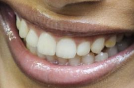 Picture of Freida Pinto teeth and smile