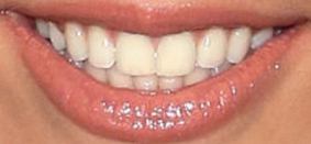 Picture of Gabby Barrett teeth and smile