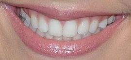 Picture of Gabby Barrett teeth and smile