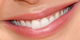 Picture of Gal Gadot teeth and smile