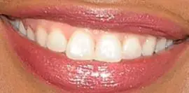 Picture of Garcelle Beauvais teeth and smile