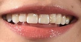 Picture of Gemma Chan teeth and smile