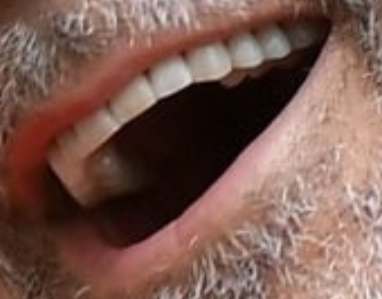 George Clooney's teeth