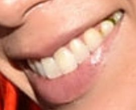 Picture of Georgina Pazcoguin teeth and smile