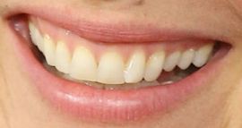 Picture of Gillian Anderson teeth and smile