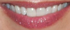 Picture of Gina Tognoni teeth and smile