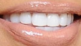 Picture of Gizelle Bryant teeth and smile