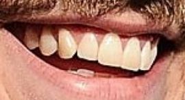 Picture of Grant Gustin teeth and smile