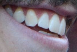 Picture of Grant Gustin teeth and smile