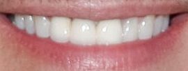 Picture of Greg Vaughan teeth and smile