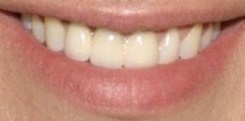 Picture of Greg Vaughan teeth and smile