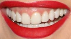 Picture of Gwen Stefani's teeth while smiling