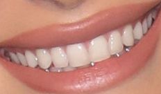 Picture of Hailey Baldwin-Bieber teeth and smile