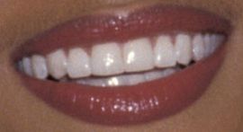Picture of Halle Berry's teeth and smile