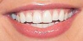 Picture of Hannah Brown teeth and smile
