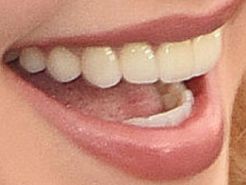 Hayden Panettiere's teeth and smile