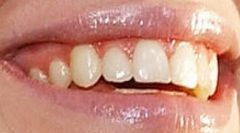 Picture of Hilary Duff teeth and smile