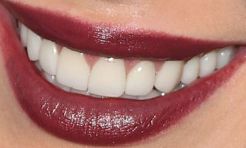 Picture of Hilary Duff teeth and smile