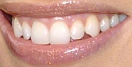Picture of Hilary Swank teeth and smile