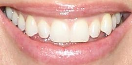 Picture of Hilary Swank teeth and smile