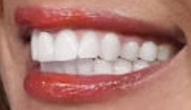 Hoda Kotb's teeth and smile