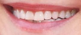 Picture of Holly Hunter teeth and smile