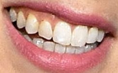 Picture of Iliza Shlesinger teeth and smile