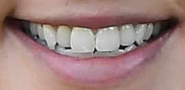 Picture of Ingrid Andress teeth and smile