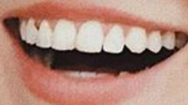 Picture of Isabel Durant teeth and smile