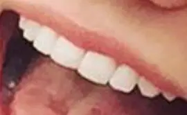 Picture of Isabel Durant teeth and smile